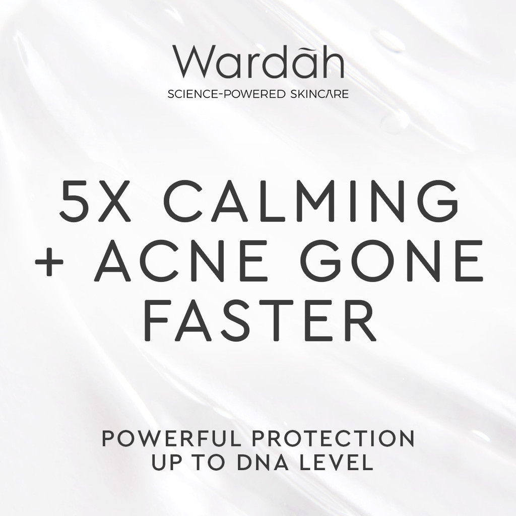 wardah uv shield acne calming sunscreen serum spf 50 pa++++ 40ml wardah uv shield acne calming sunscreen serum spf 50 pa++++ 40ml