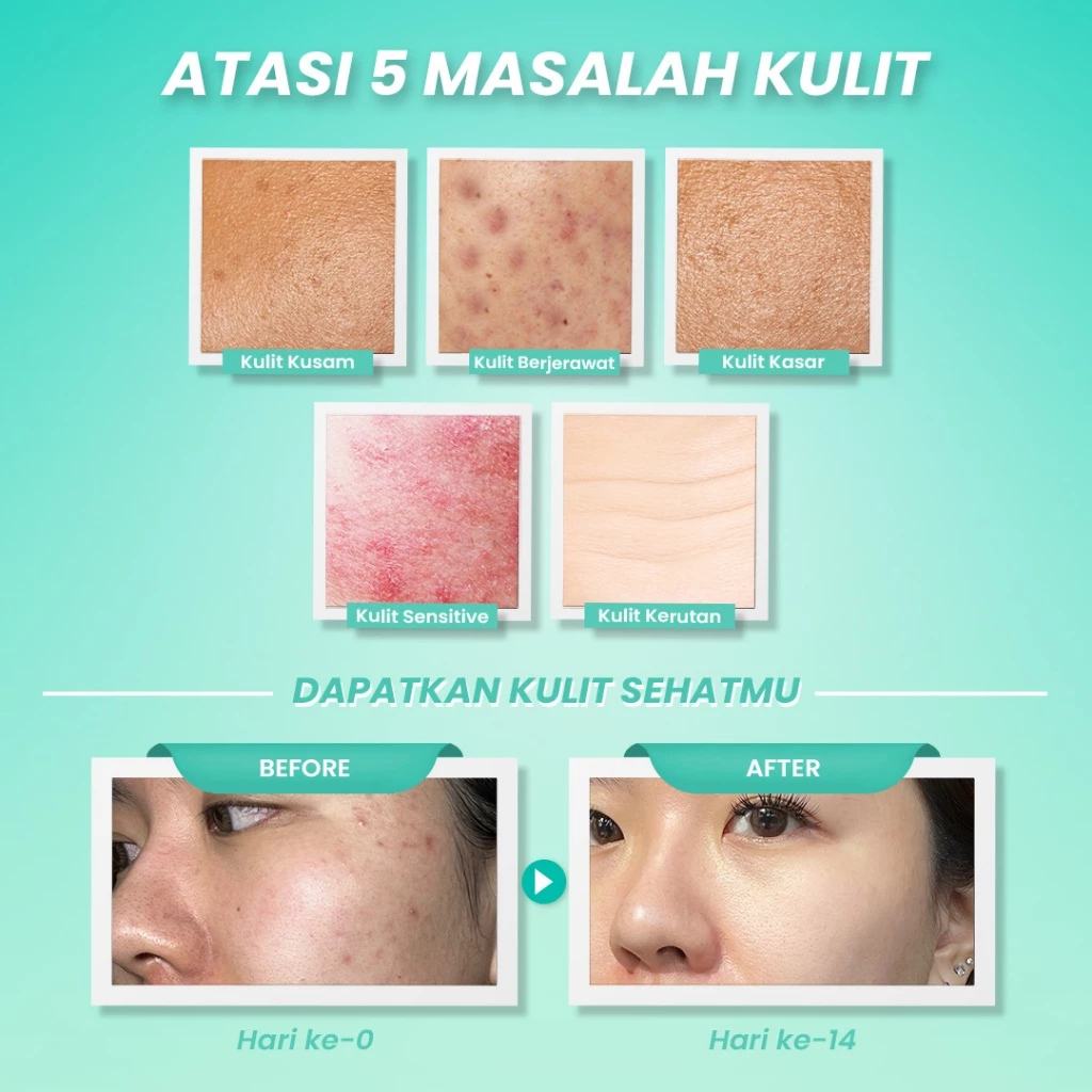 hanasui 10x ceramide probiotics peeling gel 100g / gel exfoliasi hanasui 10x ceramide probiotics peeling gel 100g / gel exfoliasi